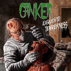 Canker - Exquisite Tenderness