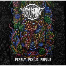 Torturation - Pearly Penile Papule